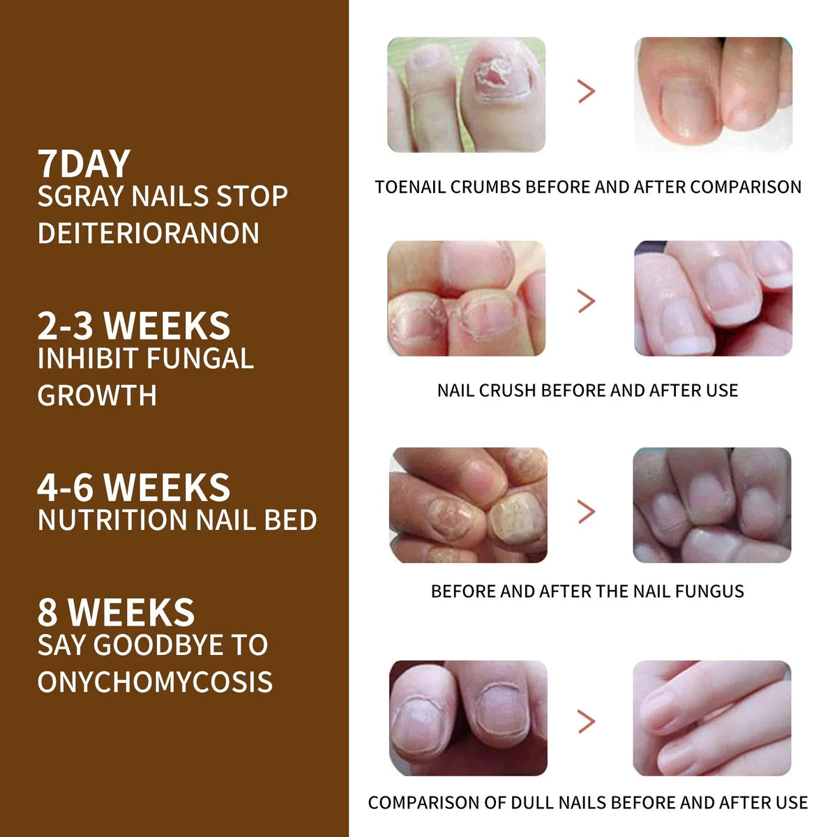 3PCSize Nail Growth Deep Healing Organic Sizeerum, Nail Growth Nail Sizeerum, Reconstrux Nail Growth, Nail Growth and Sizetrengthening Sizeerum, Nail Sizeerum for Growth and Repair for Damaged Nails
