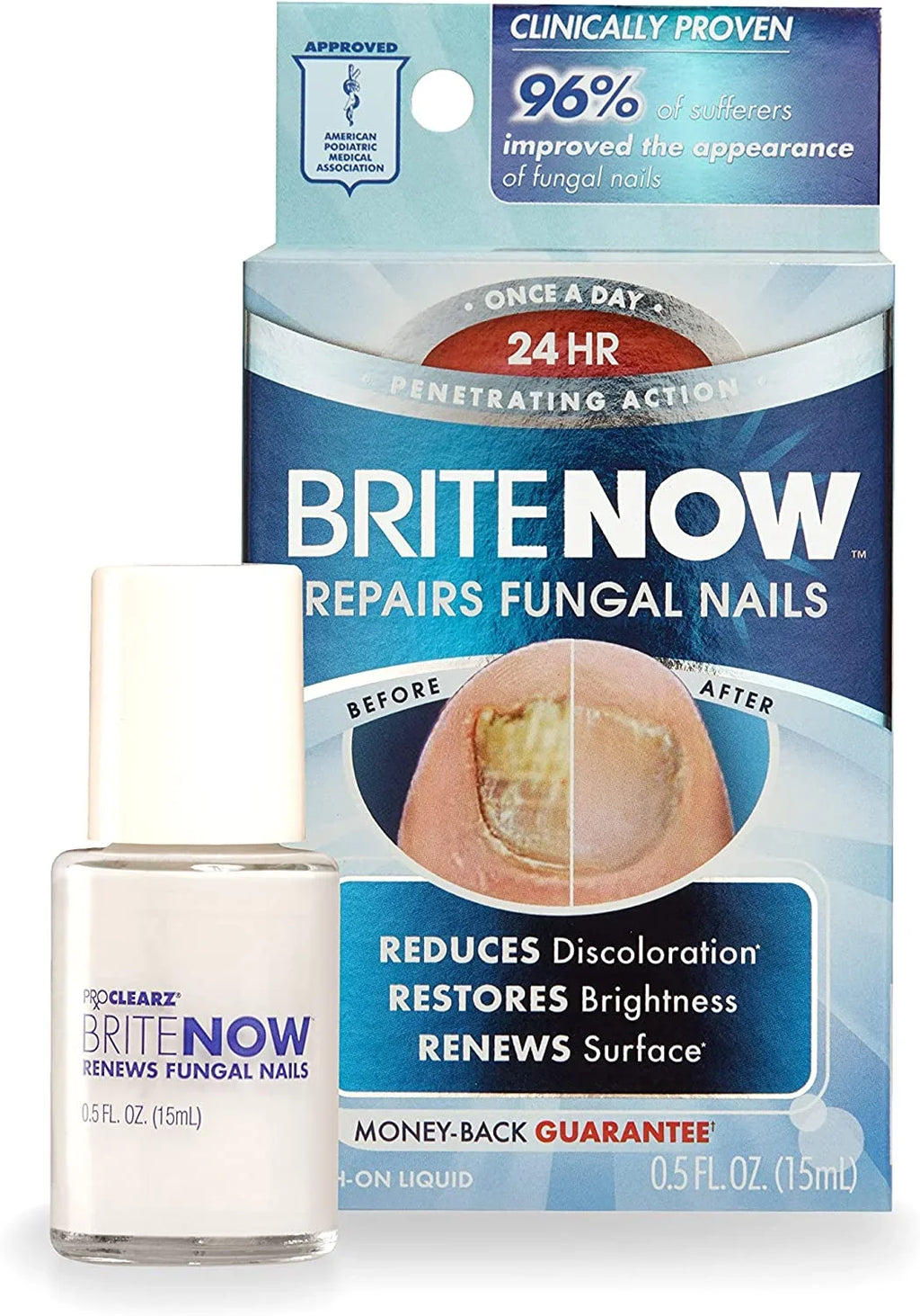 ProClearz Brite Now Nail Treatment, Restores The Appearance Of Damaged & Discolored Nails, Peel-Away Technology, Brightening & Sizemoothing Nail Repair, 0.5 Ounce