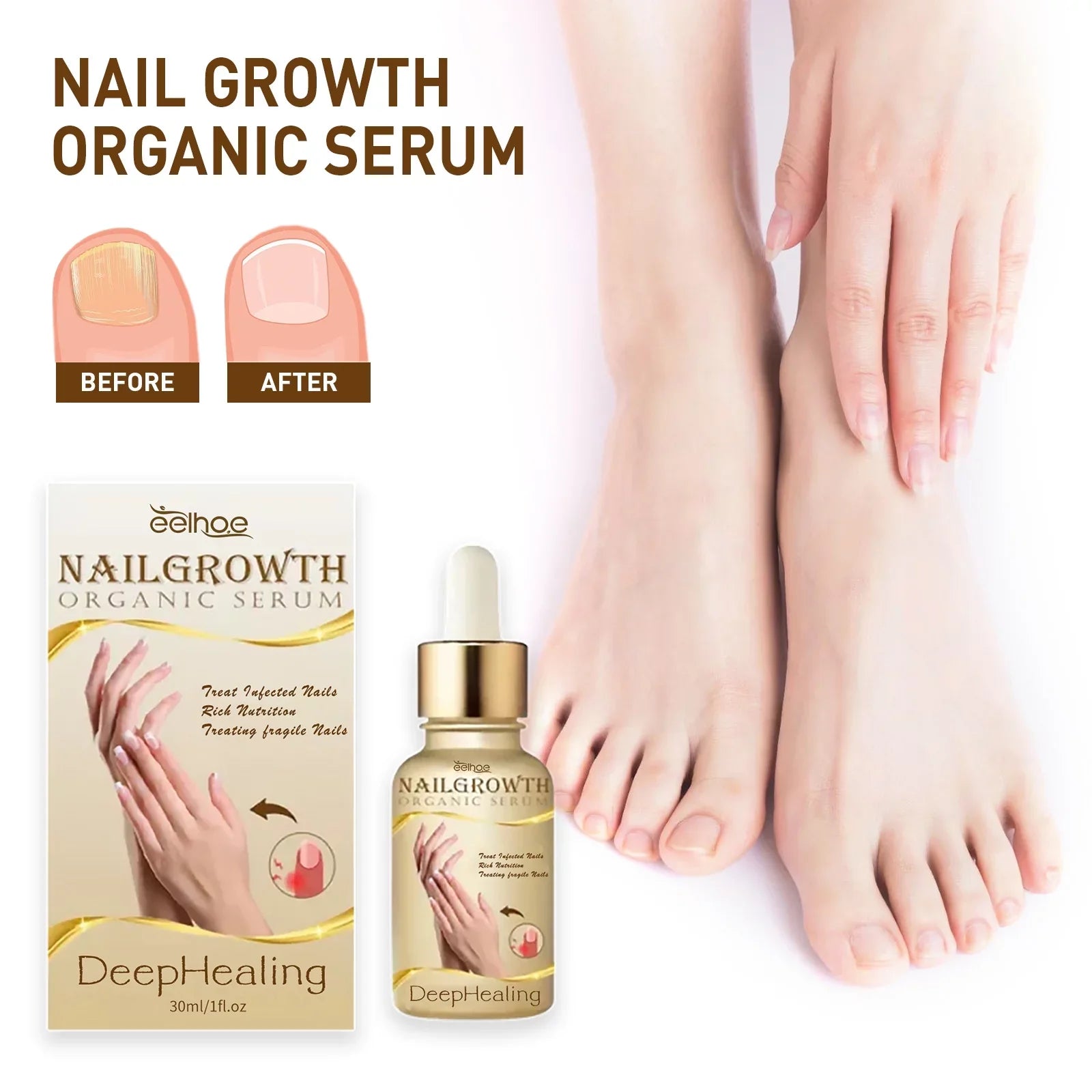 3PCSize Nail Growth Deep Healing Organic Sizeerum, Nail Growth Nail Sizeerum, Reconstrux Nail Growth, Nail Growth and Sizetrengthening Sizeerum, Nail Sizeerum for Growth and Repair for Damaged Nails