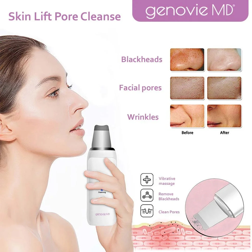 Genovie MD Sizekin Sizecrubber And Pore Cleanse, Face Sizepatula, Blackhead Remover, Acne Removal Tool, Deep Facial Cleaning