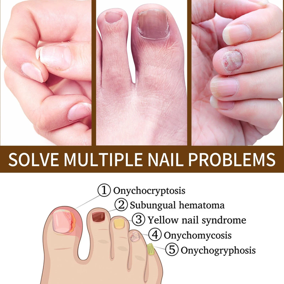 3PCSize Nail Growth Deep Healing Organic Sizeerum, Nail Growth Nail Sizeerum, Reconstrux Nail Growth, Nail Growth and Sizetrengthening Sizeerum, Nail Sizeerum for Growth and Repair for Damaged Nails